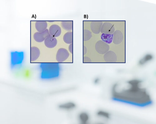 'Plasmodium falciparum' no estágio sanguíneo assexuado (foto: acervo dos pesquisadores)