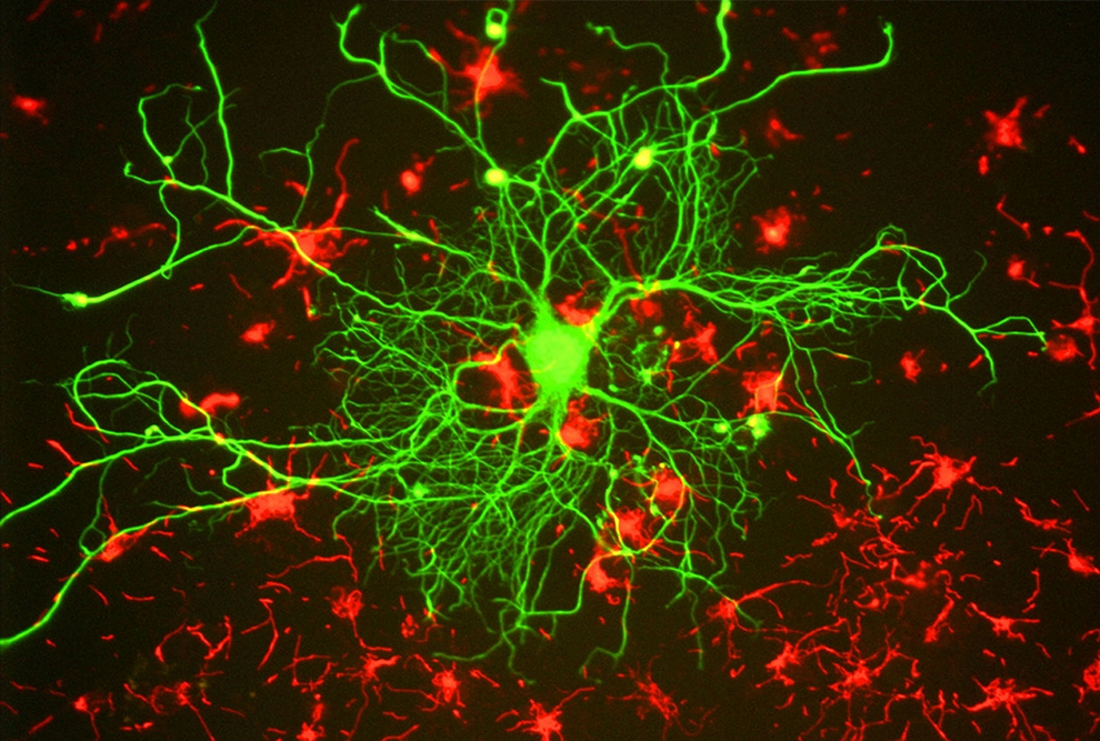 Rede de Neurônios (Foto: GerryShaw/WikimediaCommons): dados coletados pelo grupo do IB ao longo de dez anos sugerem novos tratamentos para a esquizofrenia