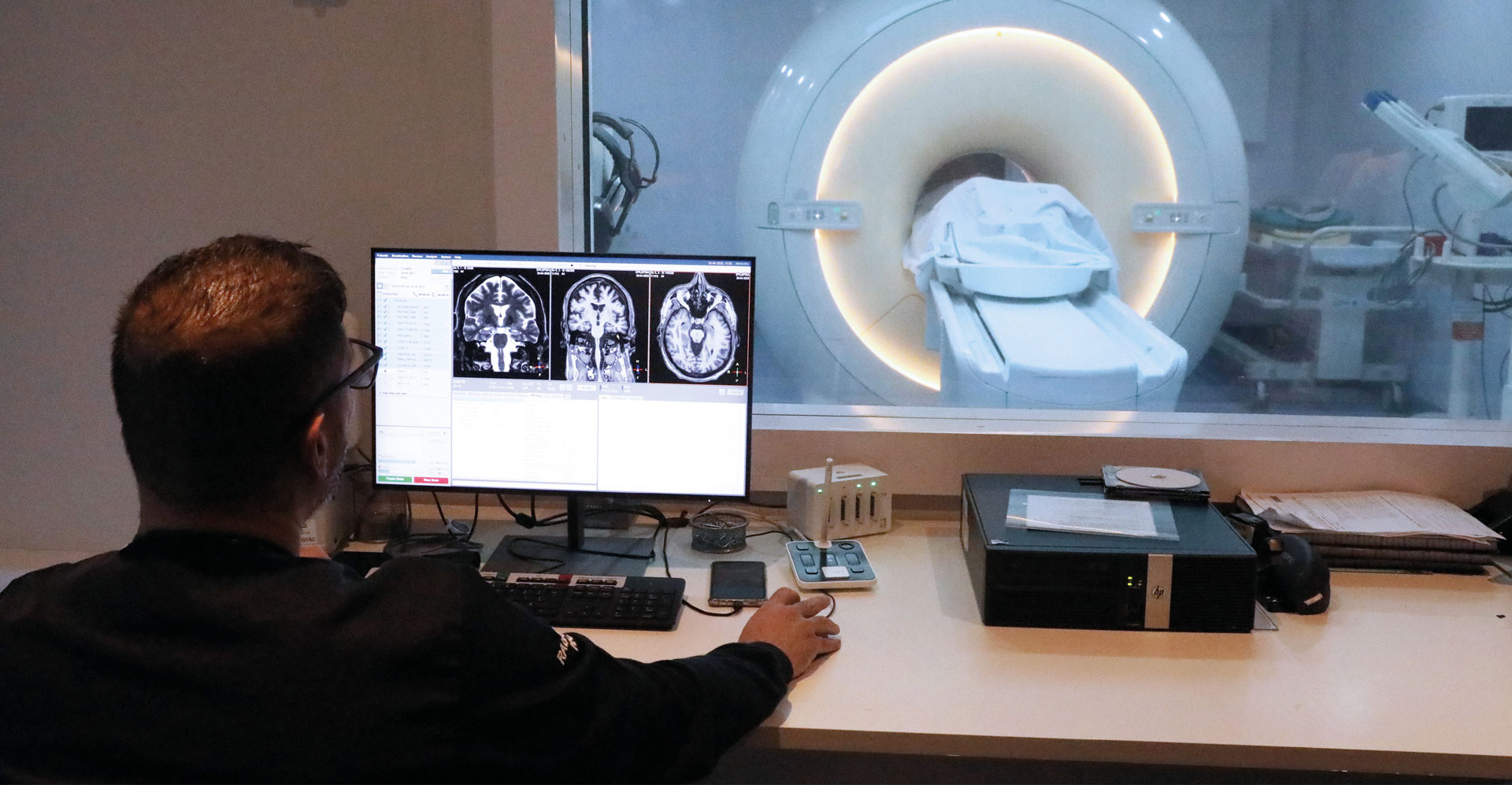 Exame de neuroimagem: dados sobre ressonância magnética e eletroencefalograma para identificar biomarcadores da doença