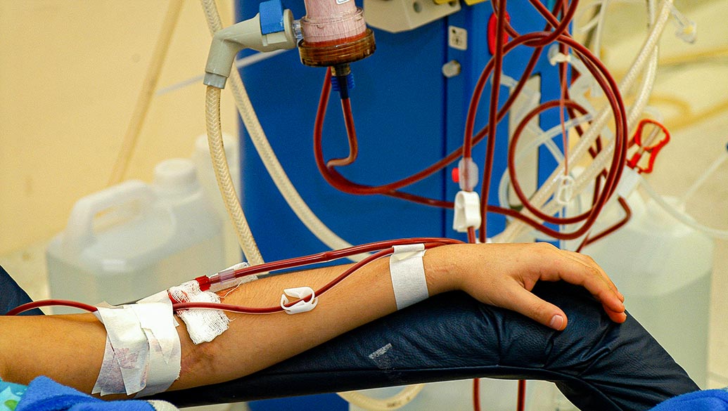 Paciente durante tratamento de hemodiálise no Hospital de Clínicas da Unicamp 