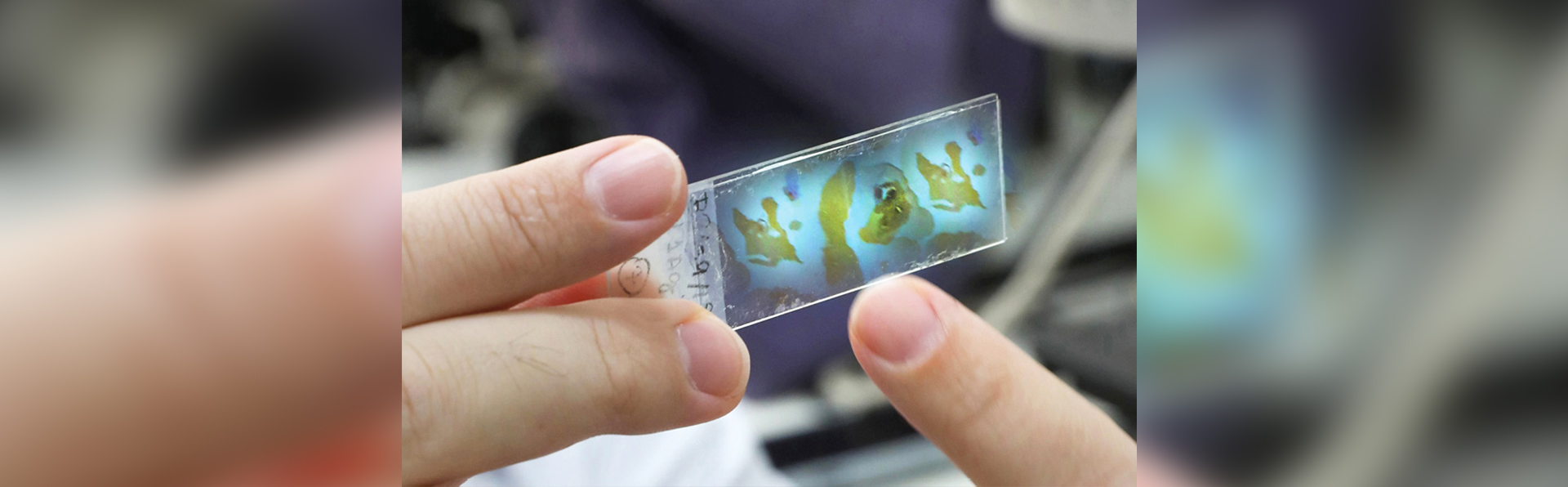 Duas mãos seguram uma lâmina de microscópio transparente. A lâmina mostra manchas coloridas em tons de azul, verde e amarelo, lembrando formas orgânicas. Os dedos que a seguram estão próximos à câmera, e o fundo aparece desfocado